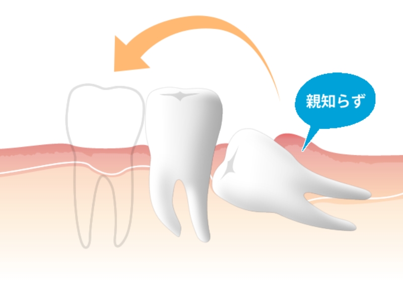 最初にお伝えしたいこと